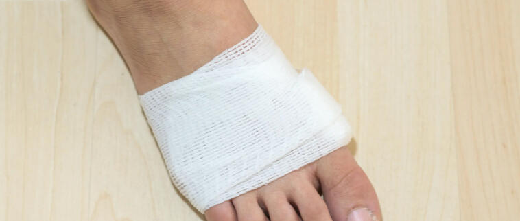 新发现的聚合物可大大促进糖尿病伤口的愈合速度