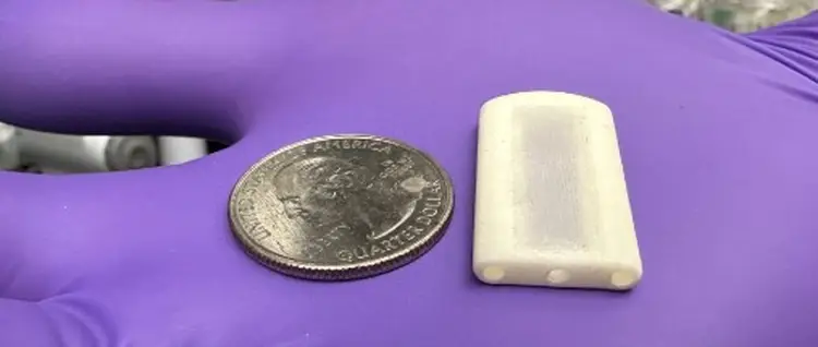 可以改变1型糖尿病治疗方式的3D打印植入式药物研究初见成效 可以改变1型糖尿病治疗方式的3D打印植入式药物研究初见成效