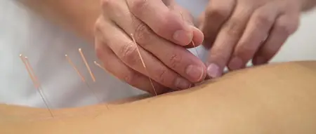研究:针灸疗法可防治糖尿病及其并发症