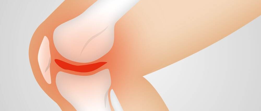 研究：二甲双胍可降低骨关节炎的风险