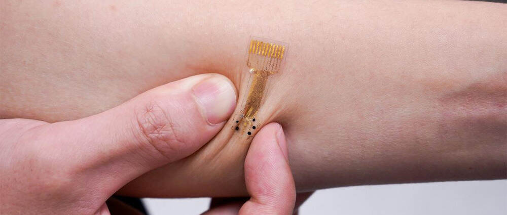 “智能”绷带以监测和治疗糖尿病性皮肤溃疡等慢性伤口