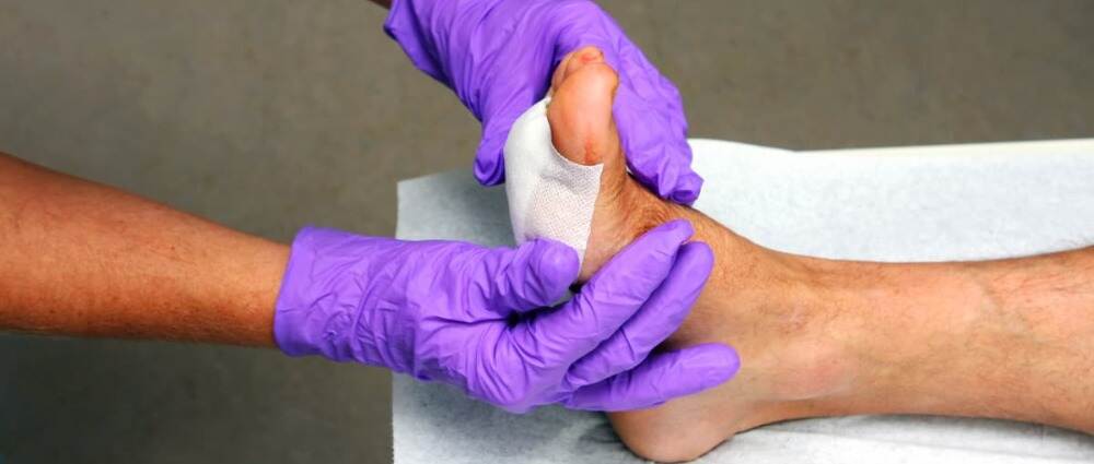 研究：电流刺激使糖尿病伤口愈合快3倍