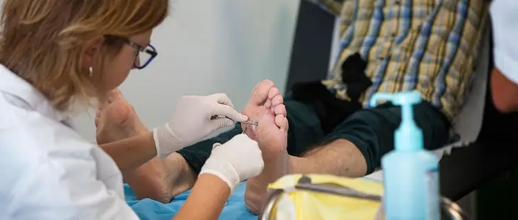 研究:外用艾司洛尔凝胶可帮助治愈糖尿病足溃疡 研究:外用艾司洛尔凝胶可帮助治愈糖尿病足溃疡